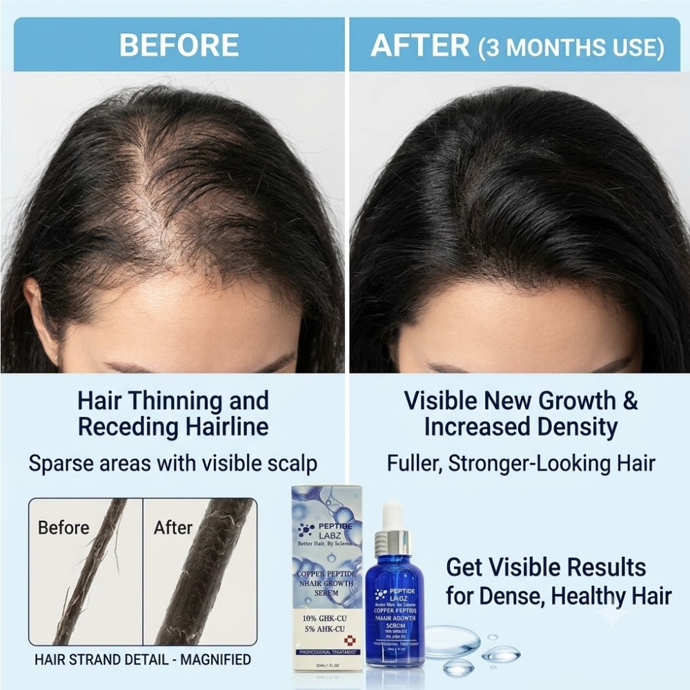 Esensi Pertumbuhan Rambut Pept - Hair Care Elseve ulasan dan harga