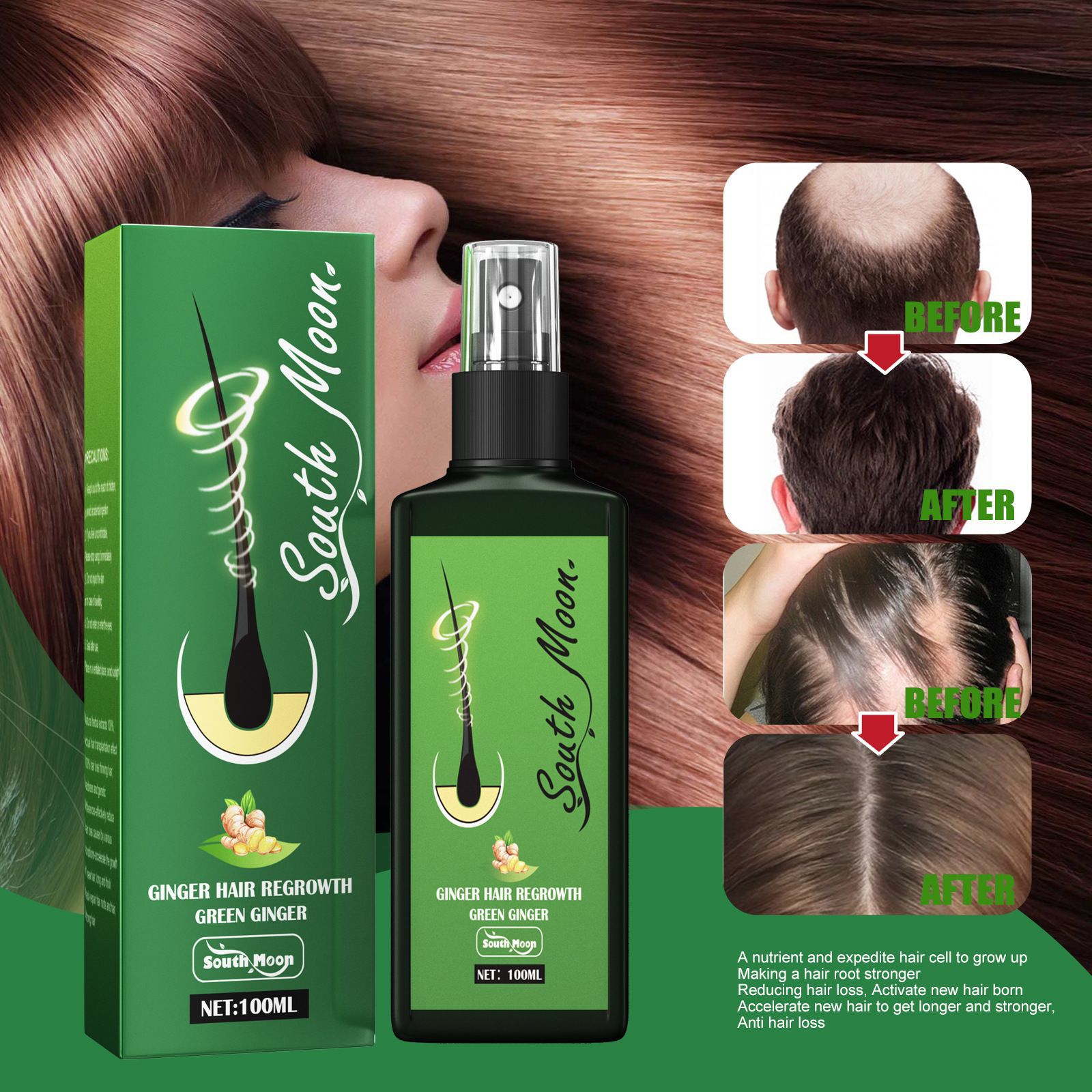 Semprotan Penumbuh Rambut Jahe - Hair Care Elseve ulasan dan harga