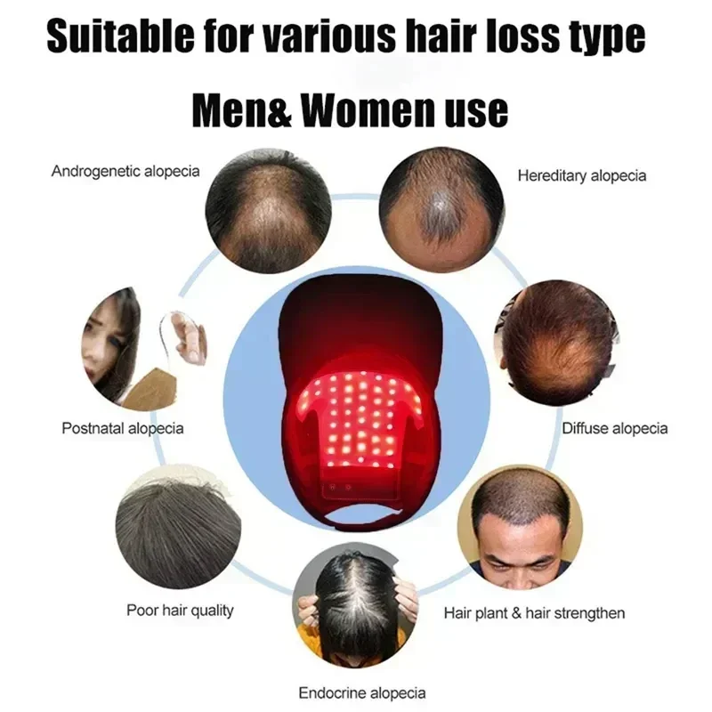 Topi Terapi Cahaya Merah Biru  - Hair Care Elseve ulasan dan harga