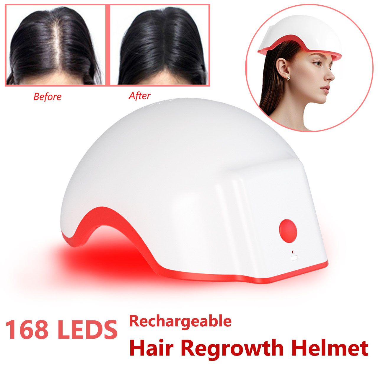 Topi Terapi Cahaya Merah, Helm - Hair Care Elseve ulasan dan harga